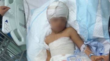 العناية الإلهية تنقذ طفلاً من الموت بين أنياب كلاب ضالة في طريف